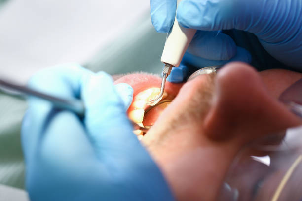 Best Pediatric Emergency Dentist in Walker Mill, MD