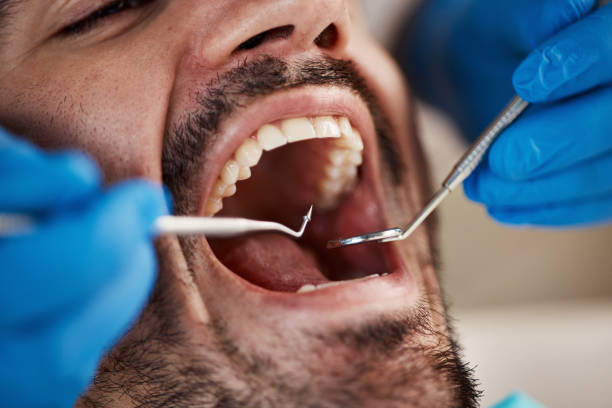 Best Emergency Broken Tooth Repair in Walker Mill, MD
